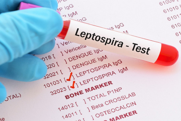 Waspada Leptospirosis saat Musim Hujan